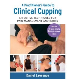 A Practitioner’s Guide to Clinical Cupping